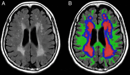 Figure 1
