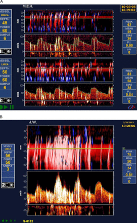 Figure 3
